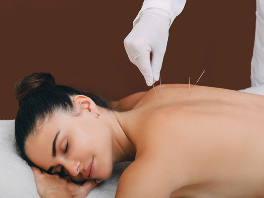 How to Know You’ve Found the Right Acupuncturist: Skills, Energy, and Intention