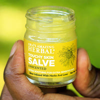 Touchy Skin Salve, Eczema Cream Ointment for Sensitive Skin